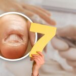 Onicofagia, 7 consigli per smettere di mangiarsi le unghie